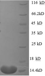 CSB-EP006147HU1