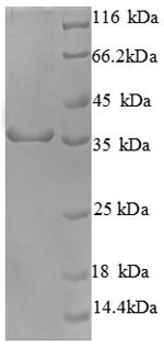 CSB-EP005065HU