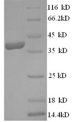 CSB-EP001836HU1