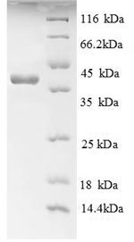 CSB-EP001441HU