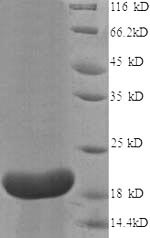 CSB-EP011609HU1