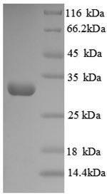 CSB-EP013038HU1a0