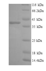 CSB-YP011665HU